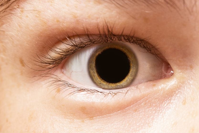 closeup of a dilated eye