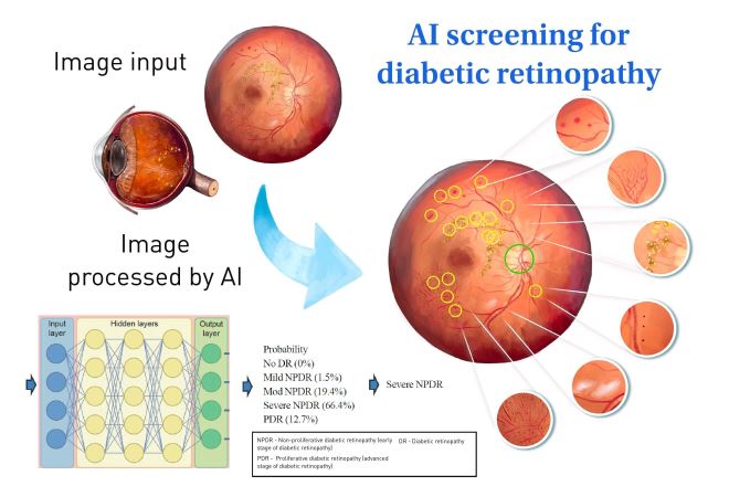 AI Eye Exam