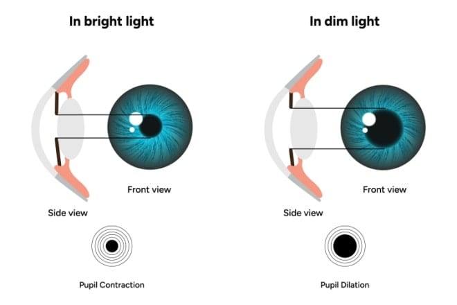 What is a dilated eye exam and when do you need one?