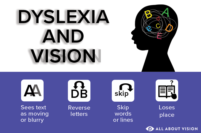 Dyslexia and vision: Are they connected? Dyslexia and vision: Are they connected?