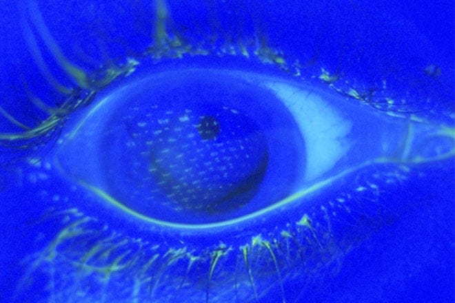 How to prevent eye injuries How to prevent eye injuries