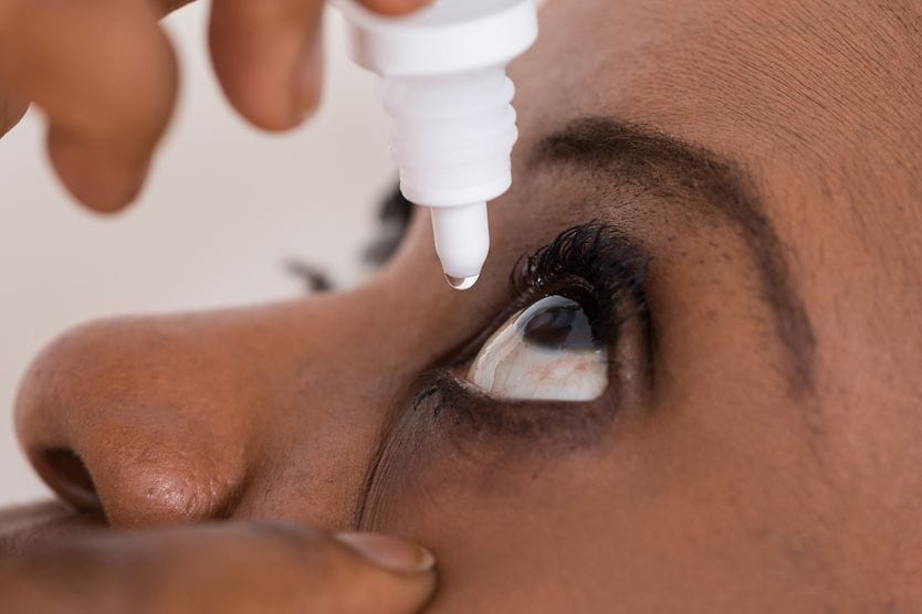How to whiten your eyes woman using eye drops to help whiten her eyes
