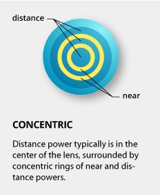 A Consumer Guide to Bifocal and Multifocal Contact Lenses