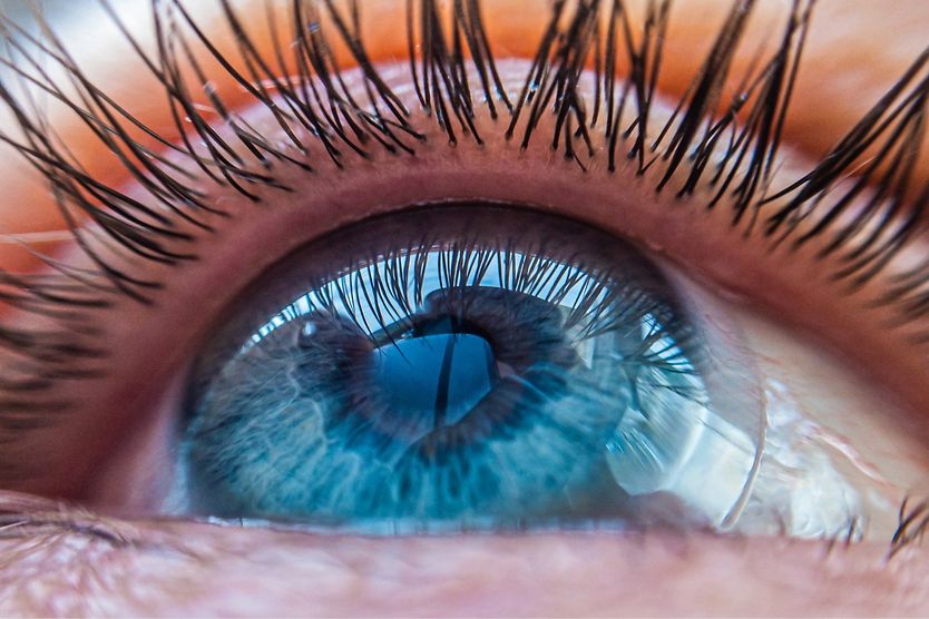 closeup of a prosthetic contact lens in eye