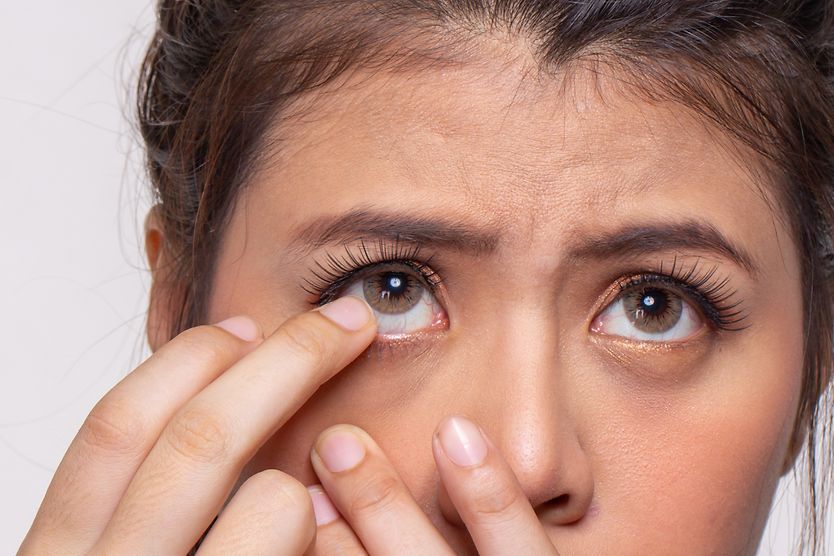 A woman with one finger near her eye as she struggles to remove a stuck contact lens. A woman with one finger near her eye as she struggles to remove a stuck contact lens.