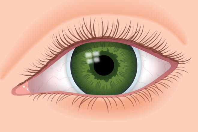 Gas permeable contact lenses (RGP or GP contacts)