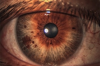 How rare is your eye color?