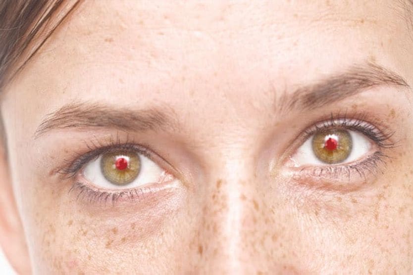 red eyes in the photo