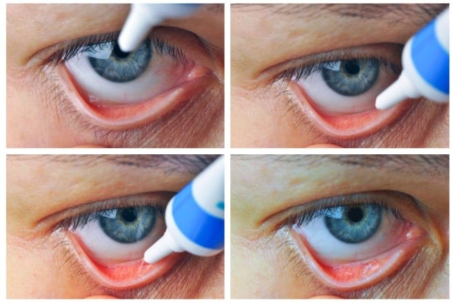 Erythromycin eye ointment: Uses, side effects and more Erythromycin eye ointment: Uses, side effects and more