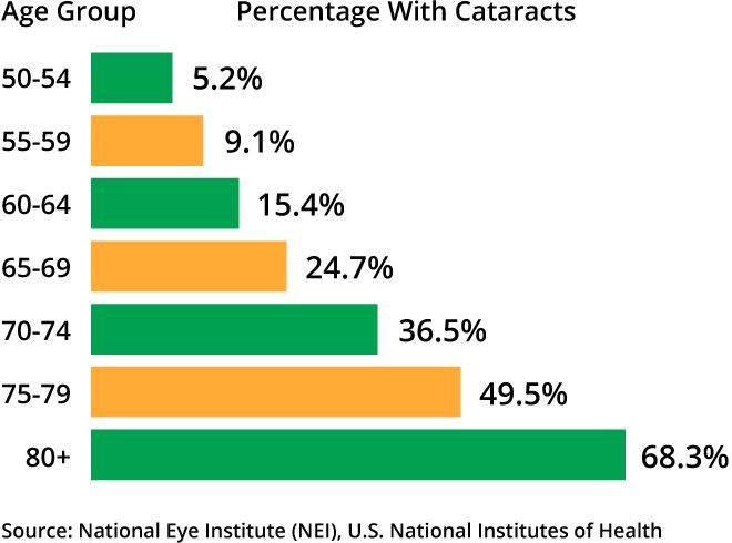 Cataract surgery