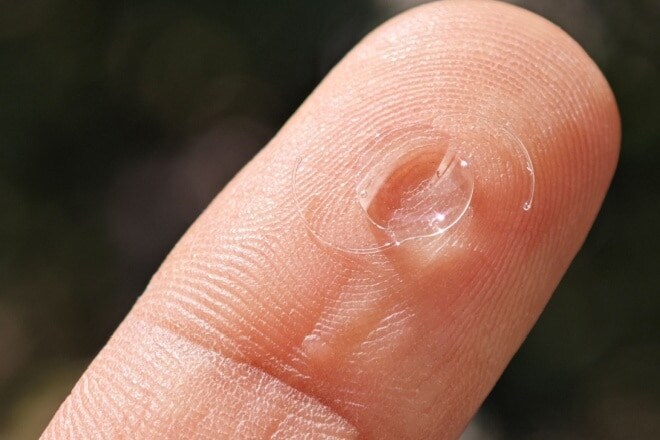 Intraocular lens implants (IOLs)