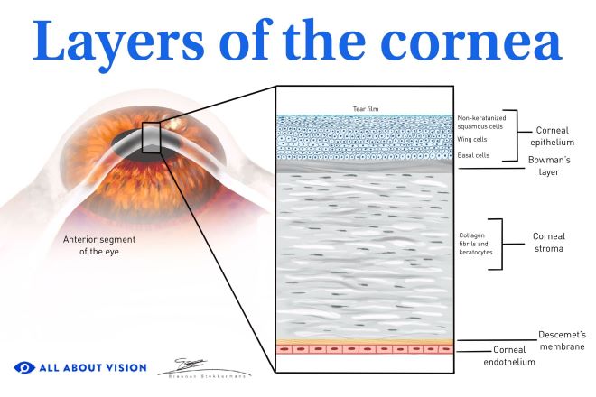 Cornea transplant Surgery Illustration