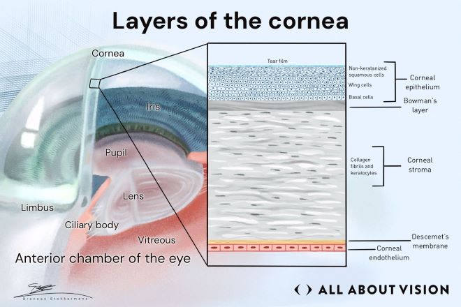 Layers of the cornea Cornea transplant Surgery Illustration