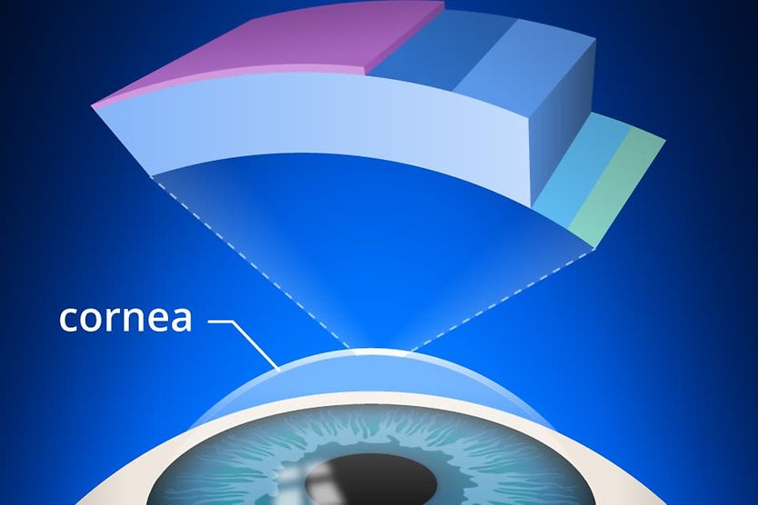 Corneal cross linking types, Symptoms and Treatment cross-section of cornea