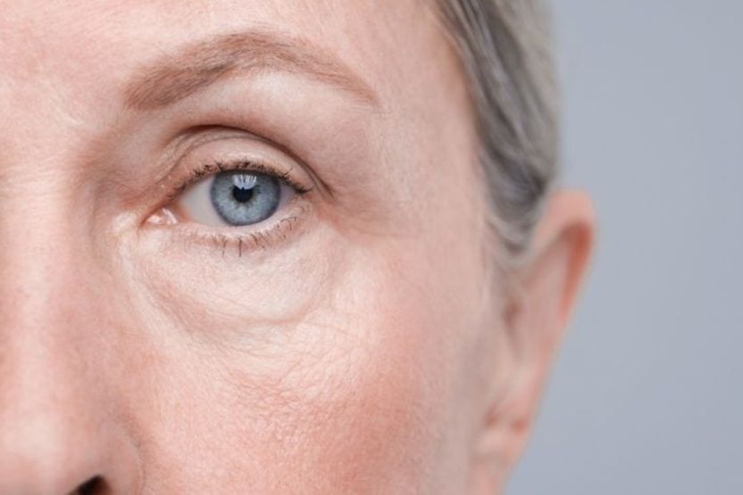 What is double eyelid surgery? closeup of a set of asian eyes before and after undergoing double eyelid surgery