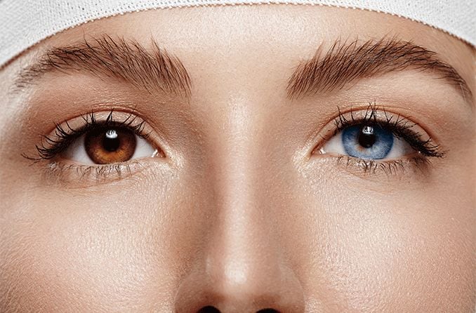 Is eye color change surgery safe?