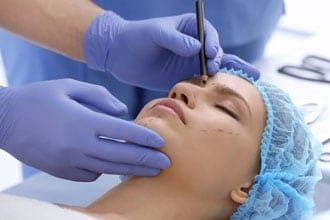 Eyelid surgery: What it is, how much it costs, what the risks are
