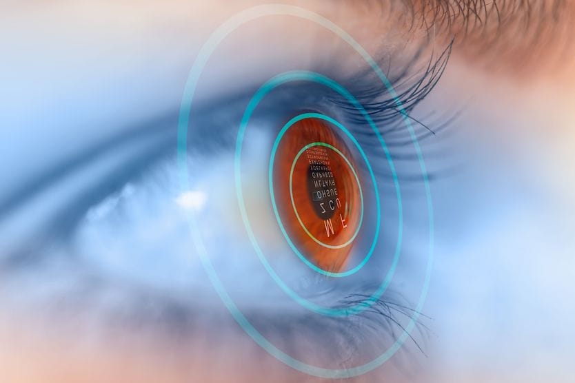 Bladeless LASIK: Femtosecond laser eases LASIK fears photo depiction of an IntraLasik procedure