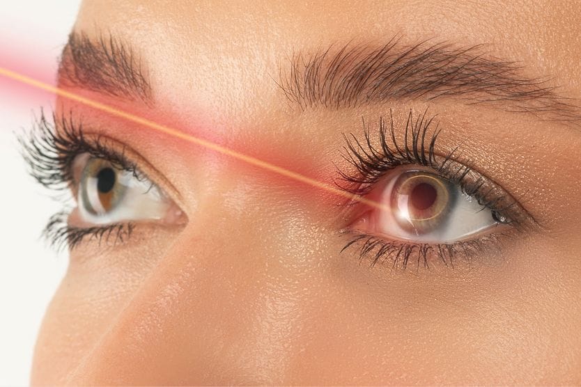 LASIK lasers: Which excimer laser is best? close up of a female eye with a laser beam