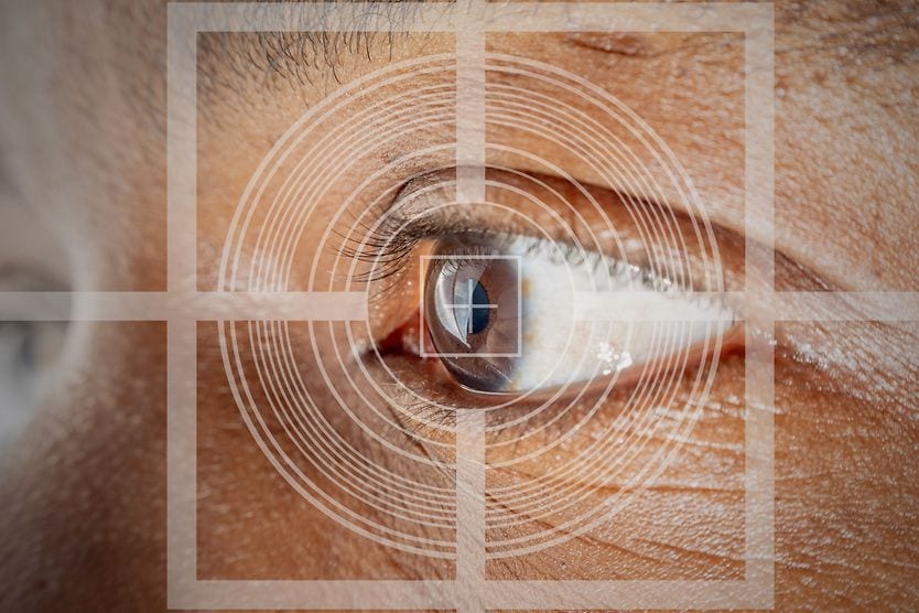 Lasik Eye Surgery