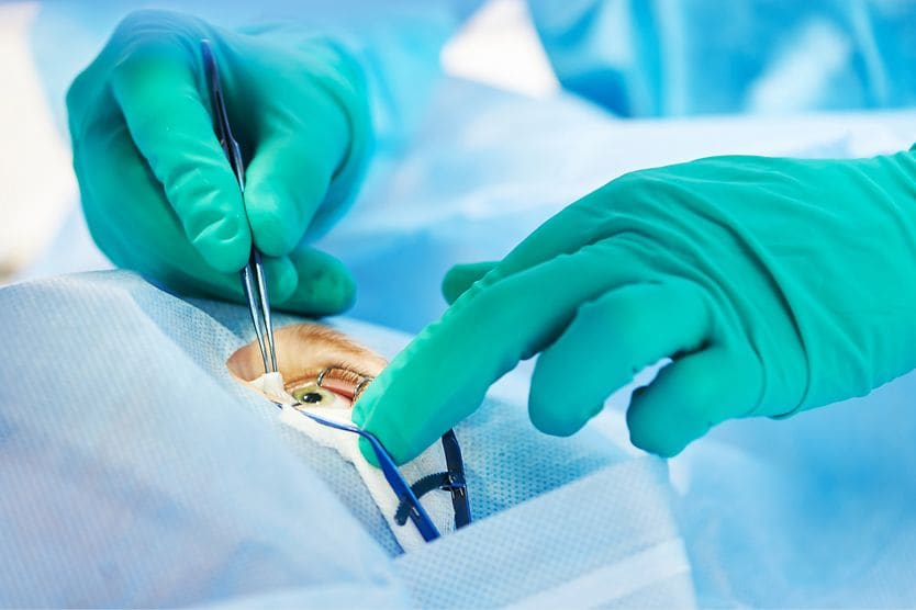 eye surgeon performing surgery