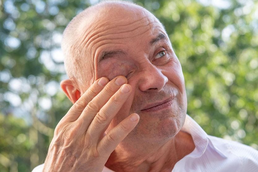 Corneal Abrasion Corneal Abrasion