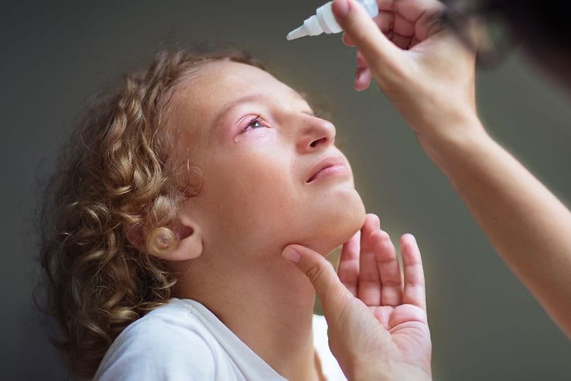 bambino a cui vengono somministrate gocce oculari per la congiuntivite