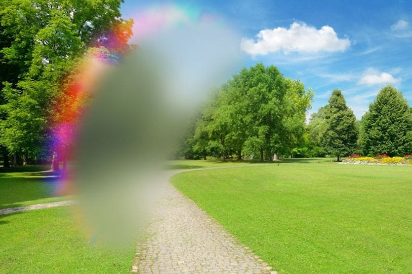 Disturbo visivo causato da un'emicrania oculare Disturbo visivo causato da un'emicrania oculare