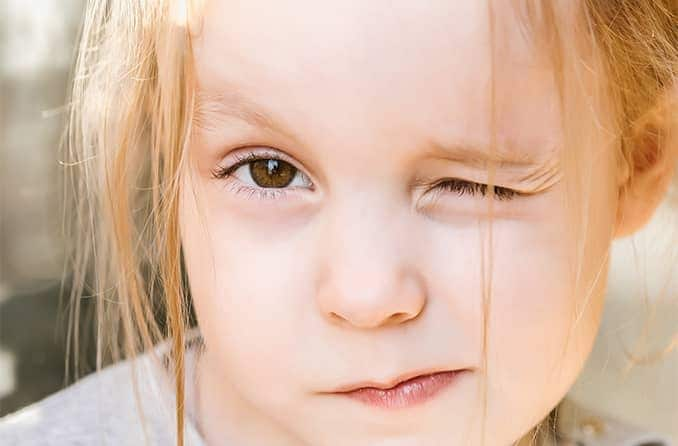 Astigmatism in infants and kids