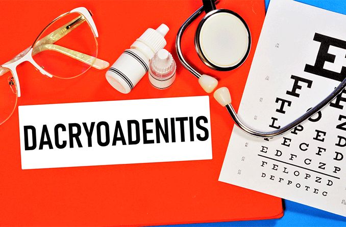 dacryoadenitis diagnosis