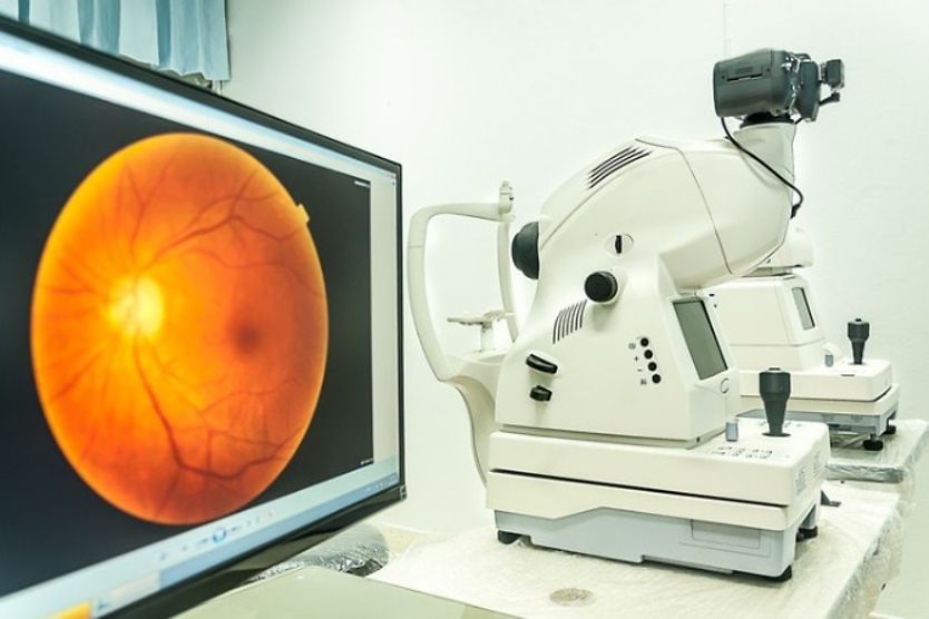 Võng mạc tách rời: triệu chứng, nguyên nhân và điều trị Võng mạc tách rời: triệu chứng, nguyên nhân và điều trị