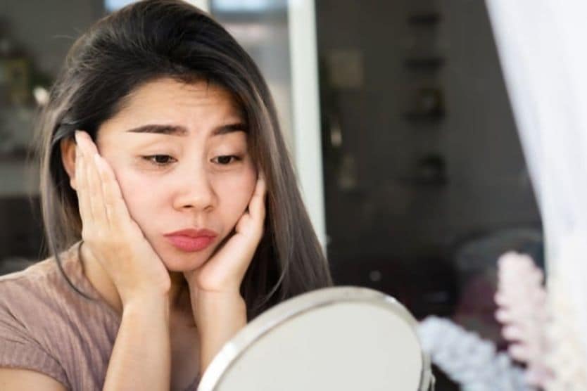 Người phụ nữ bị sụp mí mắt Người phụ nữ bị sụp mí mắt