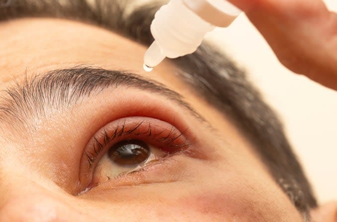 A man with a stye puts eye drops into his eye