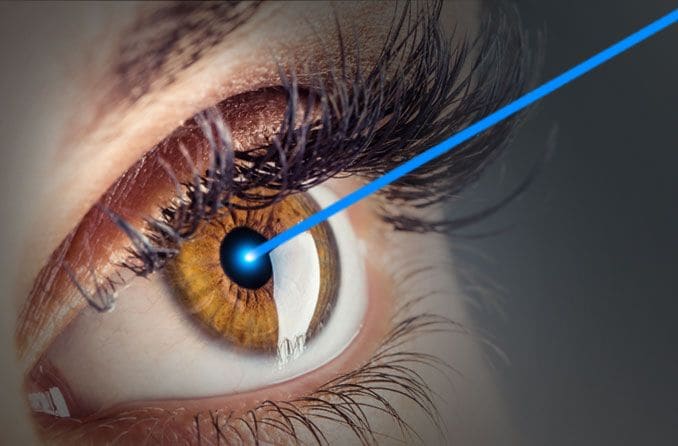 Человек, получающий косметические средства Lasik для глаз.
Chelovek, poluchayushchiy kosmeticheskiye sredstva Lasik dlya glaz.