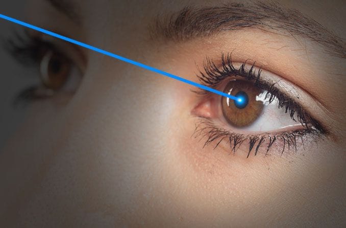 Женщина получает процедуру Lasik от пресбиопии.