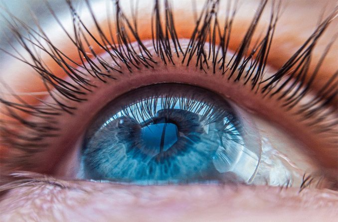 closeup of a prosthetic contact lens in eye