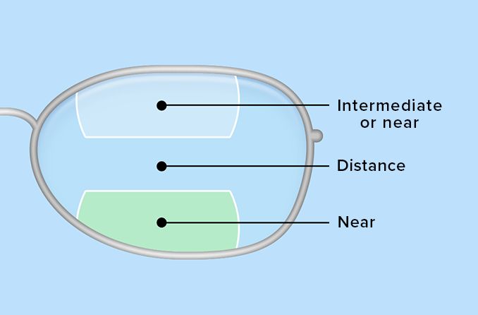 Bifocals and trifocals: Solutions for “short arms”