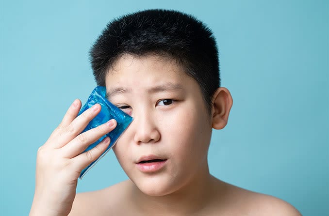 Boy treating his swollen eyelid with a cold compress