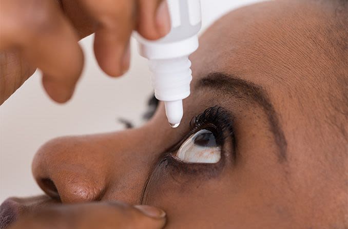 woman using eye drops to help whiten her eyes