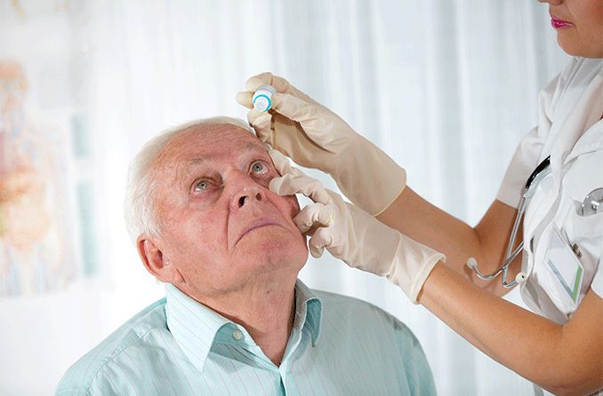 older man with glaucoma getting eye drops as glaucoma treatment