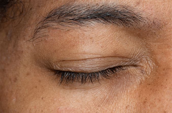 closeup of a man's eyelid