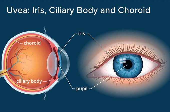 Illustration of uvea anatomy, including the iris, ciliary body and choroid.