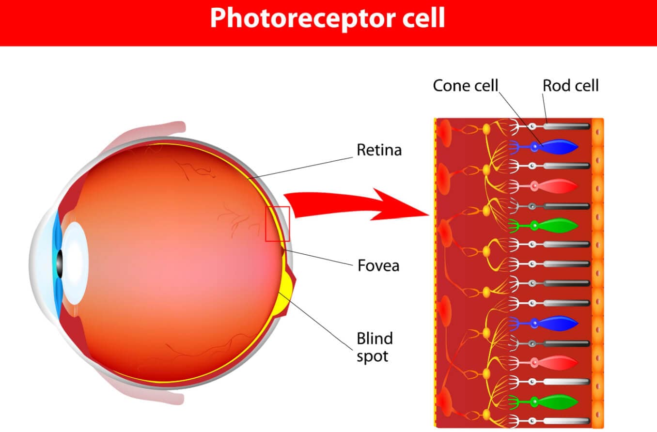 Achromatopsia