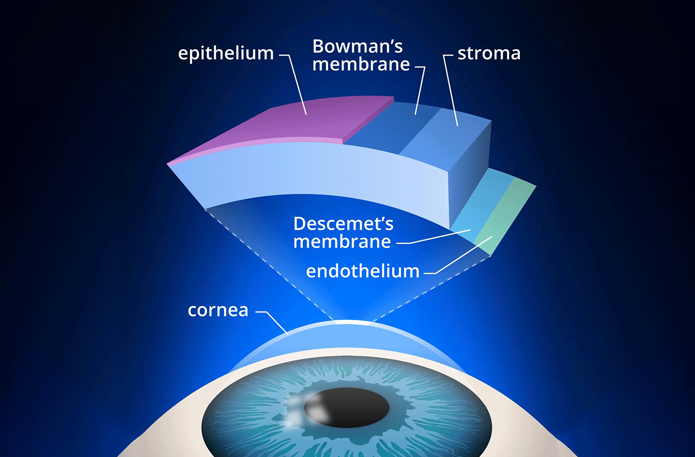 Descemetocele and corneal perforation from corneal ulcers