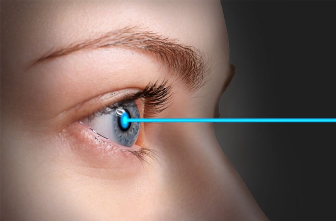 Bladeless LASIK: Femtosecond laser eases LASIK fears