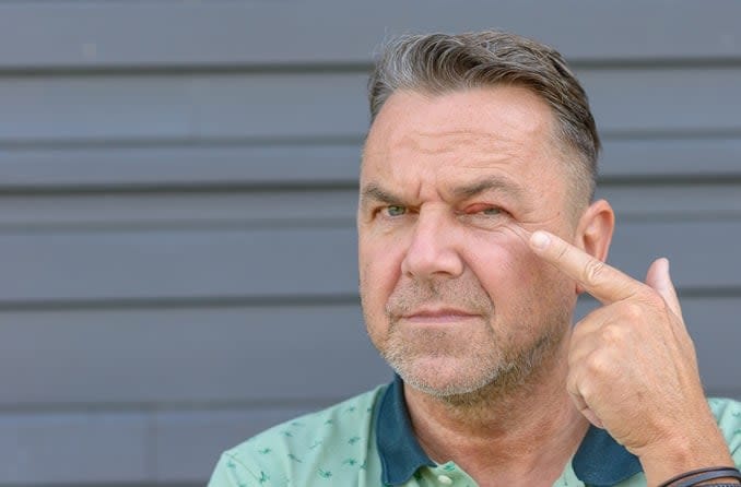 A man looks unhappy as he points to a bump on his eyelid.