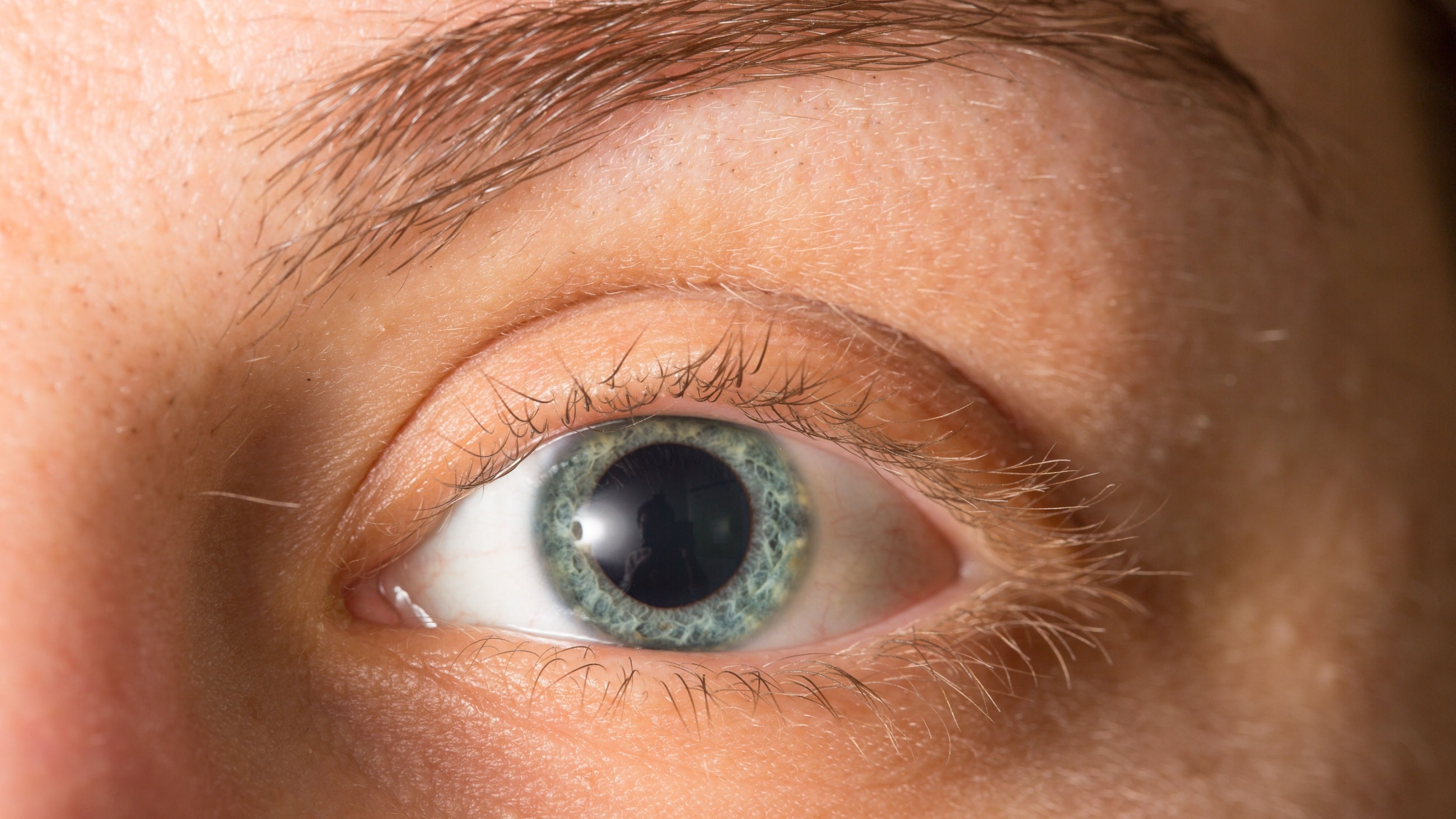 closeup of a woman's eyes after getting eye dilation exam