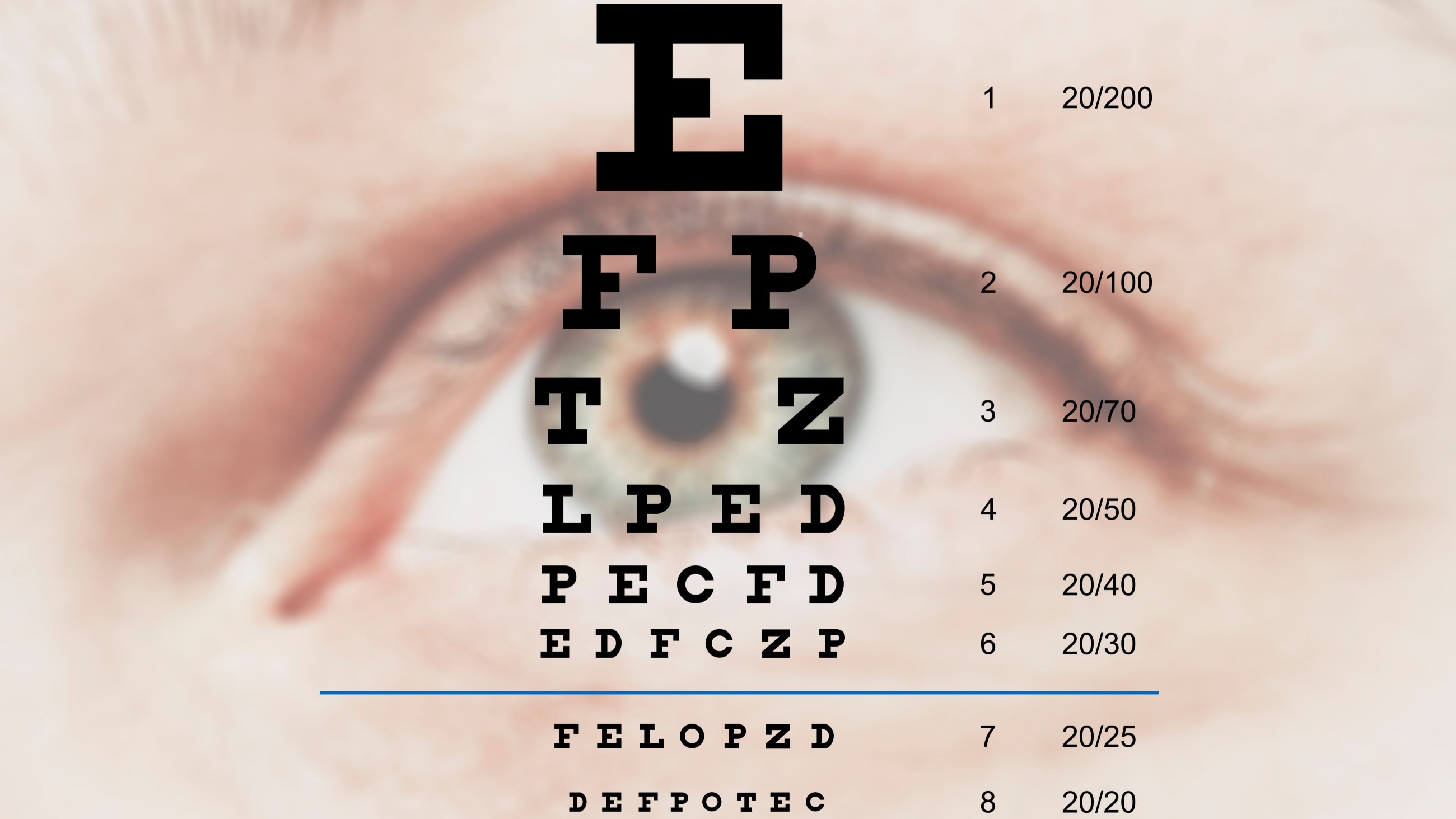 woman holding up a Snellen eye chart