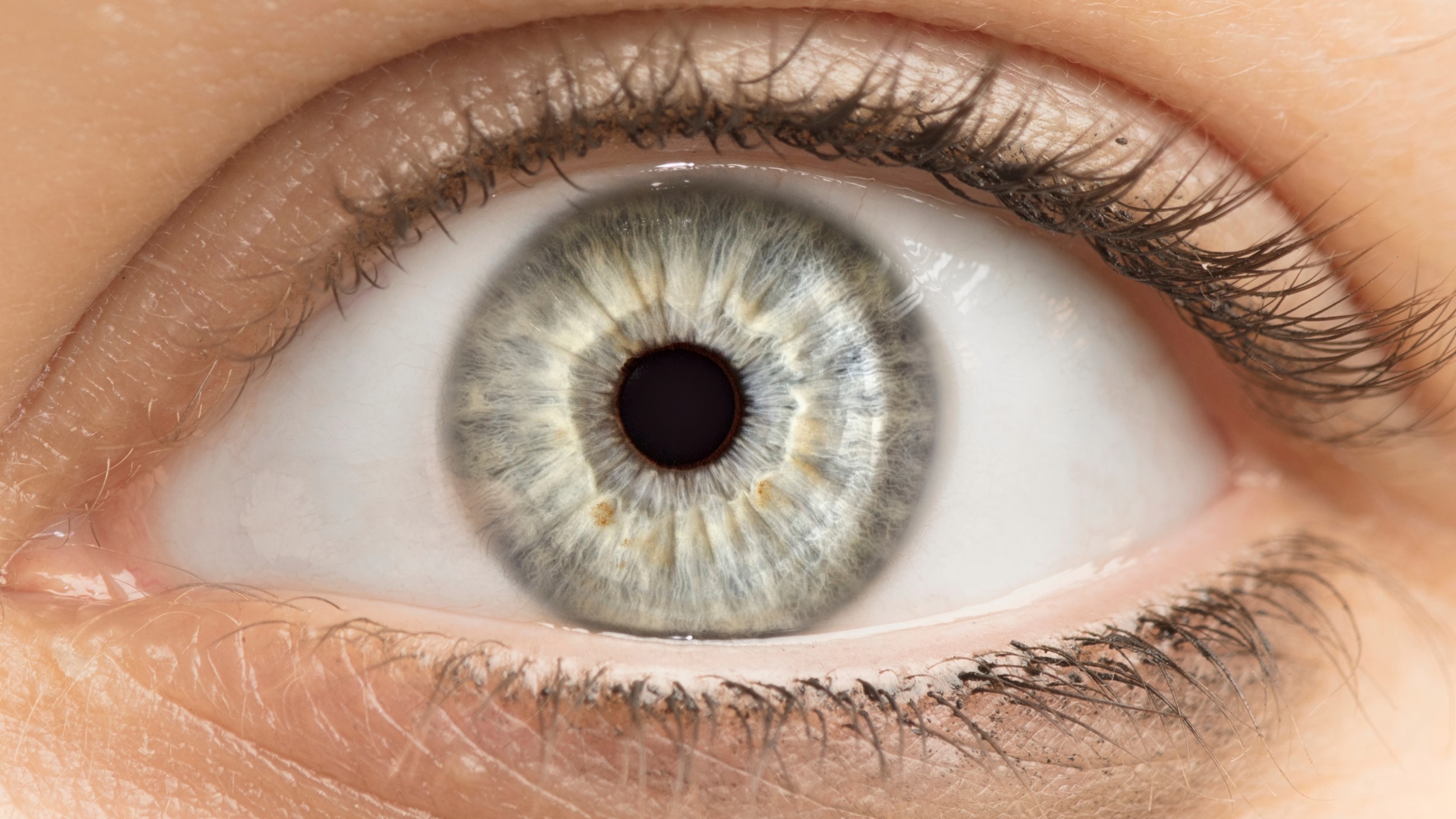 Can iridology really detect health conditions by analyzing the iris? Can iridology really detect health conditions by analyzing the iris?