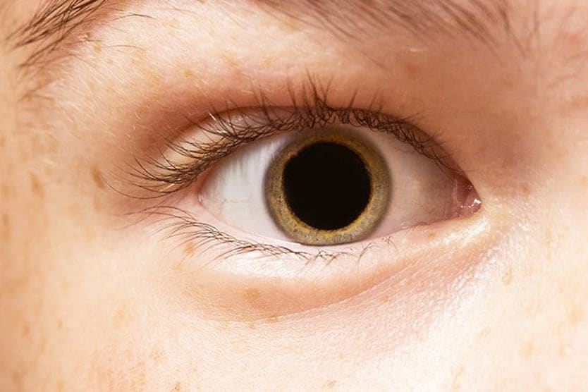 closeup of a dilated eye closeup of a dilated eye